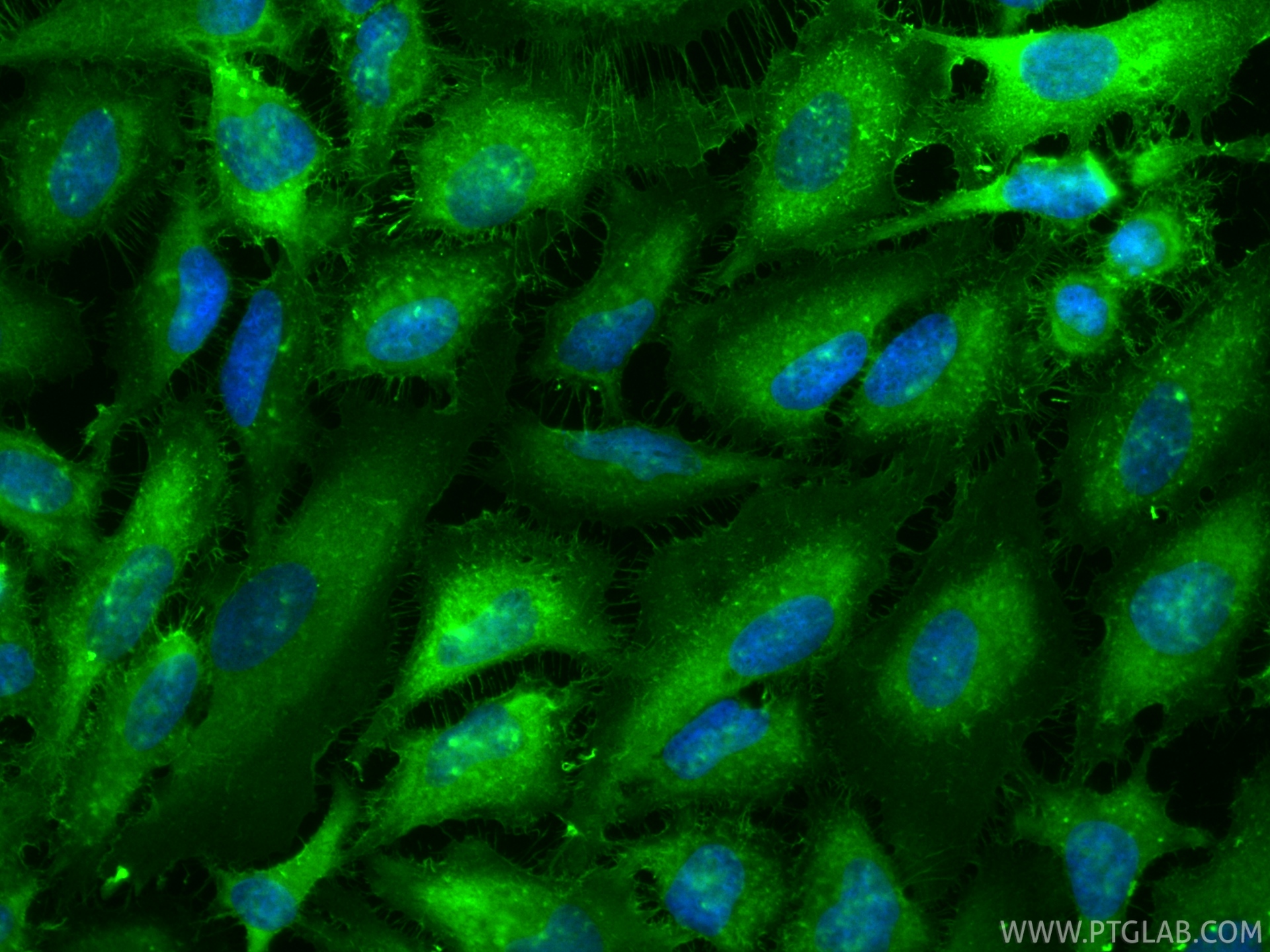 IF Staining of HeLa using CL488-85790-4 IF Staining of HeLa using CL488-85790-4