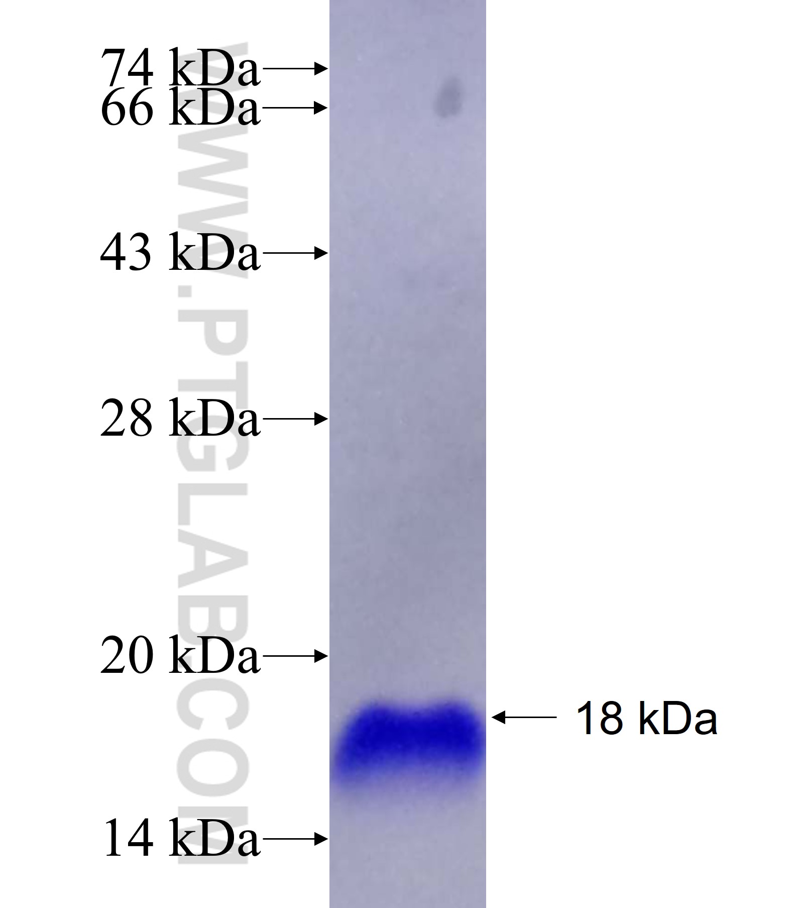 Ezrin fusion protein Ag23542 SDS-PAGE Ezrin fusion protein Ag23542 SDS-PAGE
