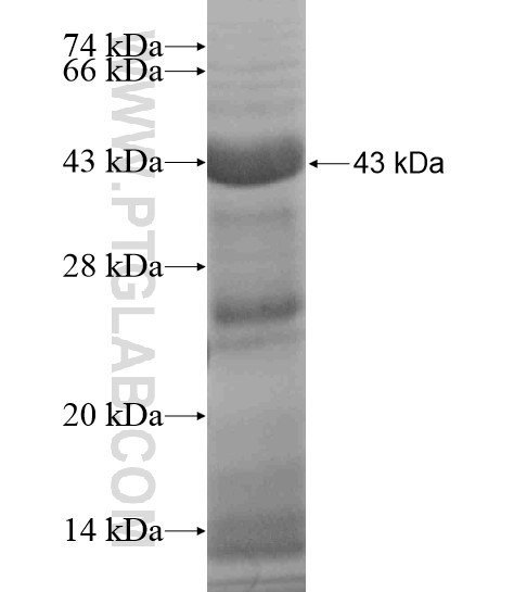 F11 fusion protein Ag19065 SDS-PAGE F11 fusion protein Ag19065 SDS-PAGE