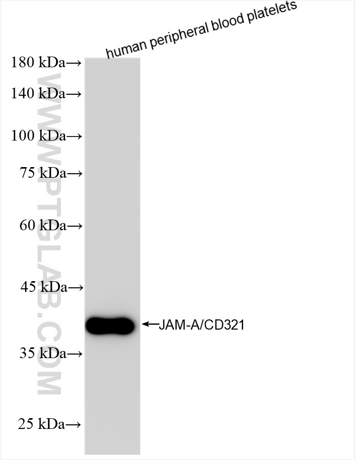 JAM-A/Junctional Adhesion Molecule A