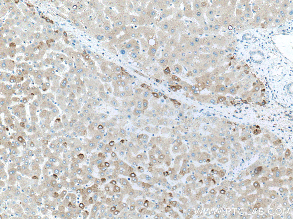 IHC staining of human liver using 12551-1-AP