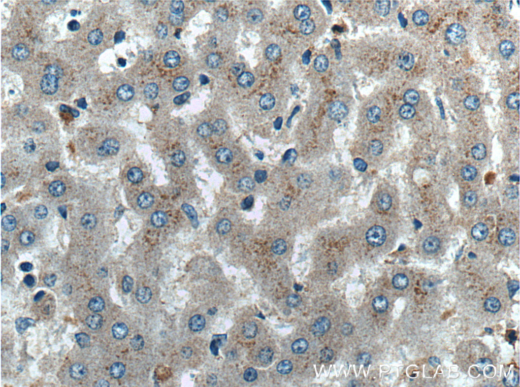 IHC staining of human liver using 27154-1-AP