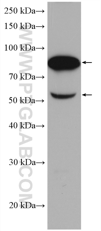 WB analysis of human plasma using 27154-1-AP