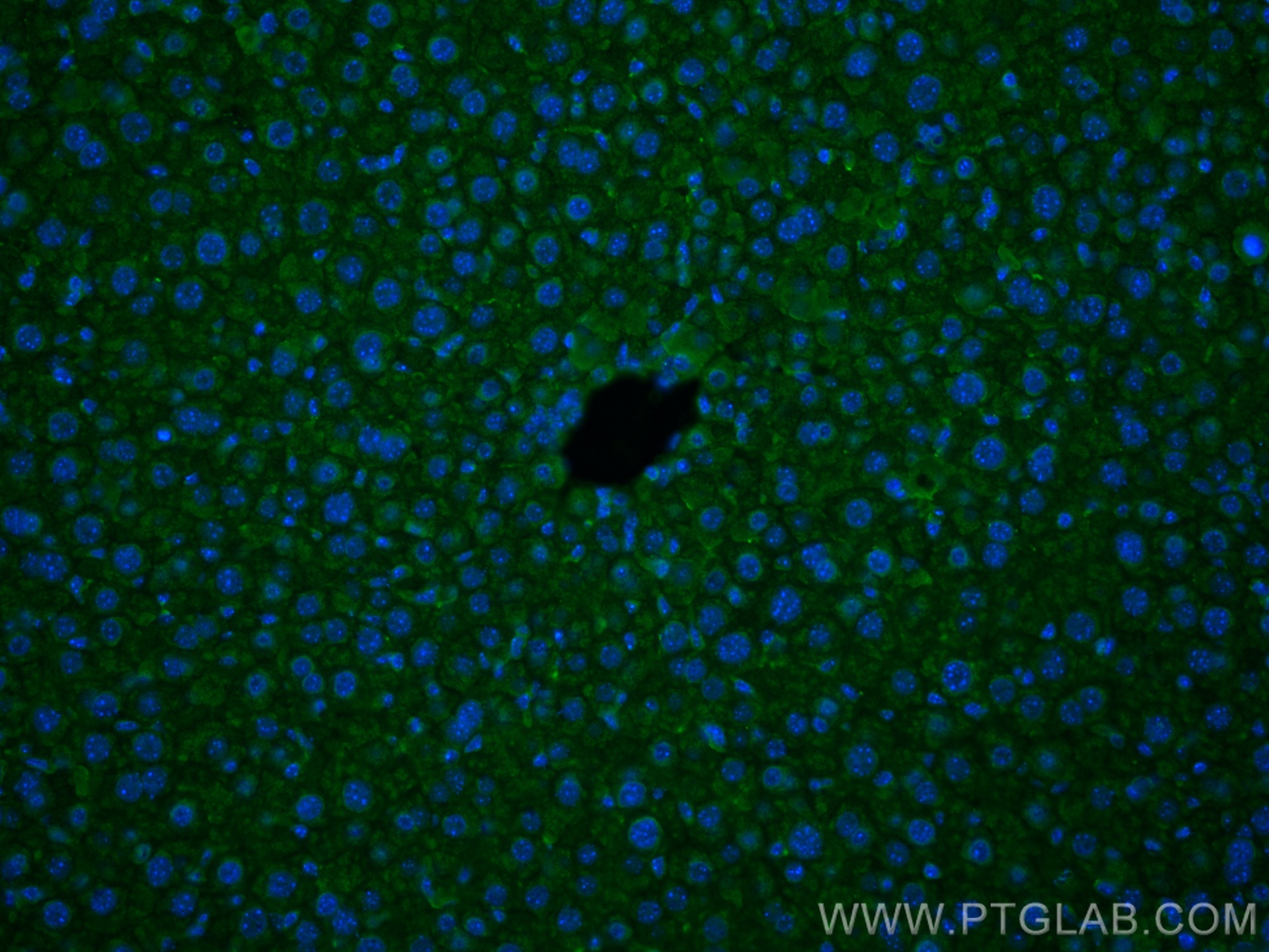 IF Staining of mouse liver using 66089-1-Ig