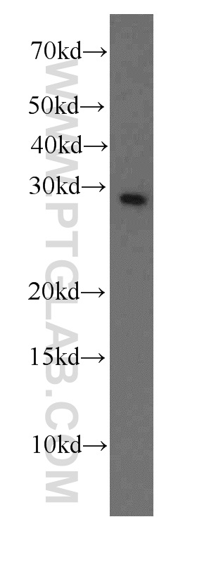 WB analysis of K-562 using 66089-1-Ig