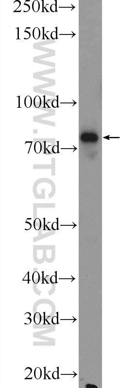 WB analysis of mouse lung using 17223-1-AP