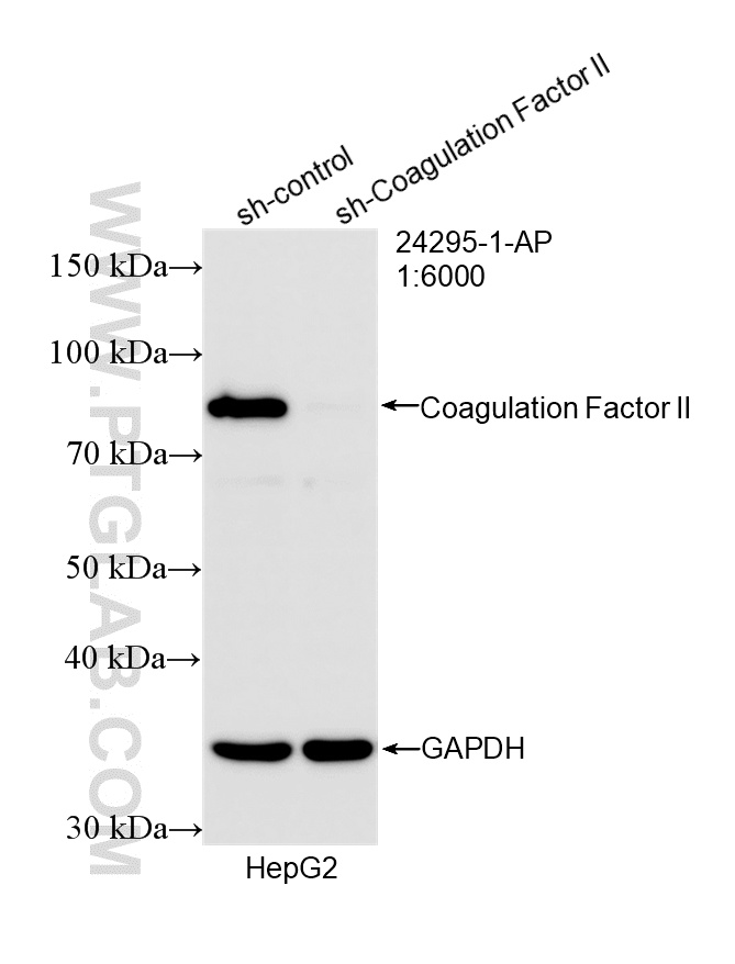 WB analysis of HepG2 using 24295-1-AP WB analysis of HepG2 using 24295-1-AP