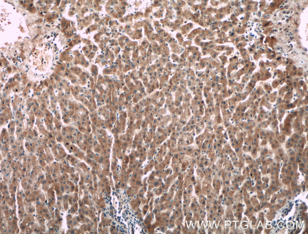 IHC staining of human liver using 66509-1-Ig