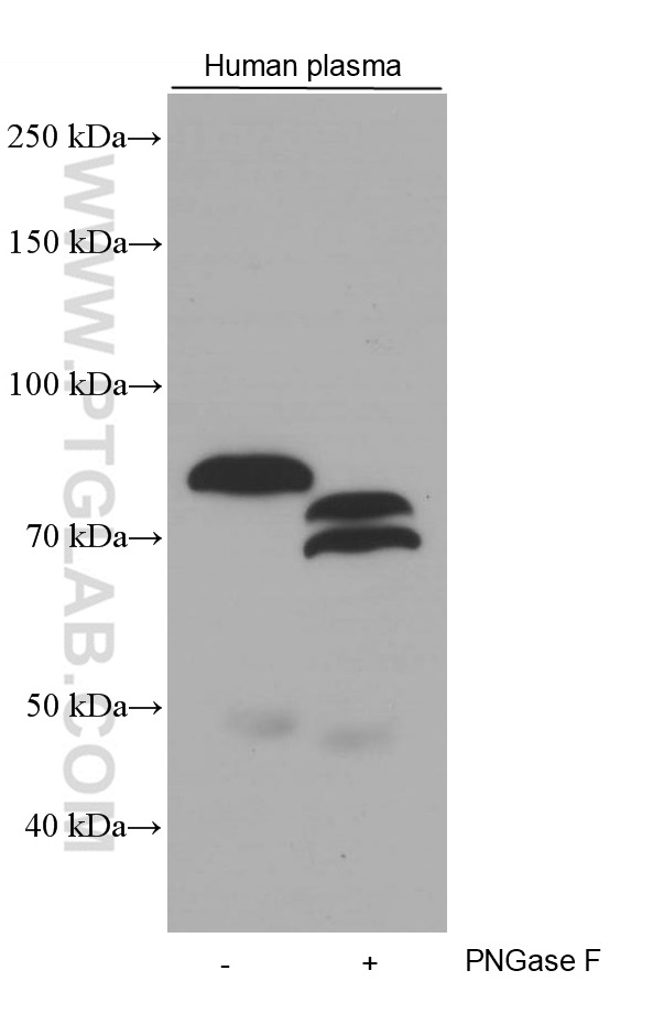 WB analysis of human plasma using 66509-1-Ig