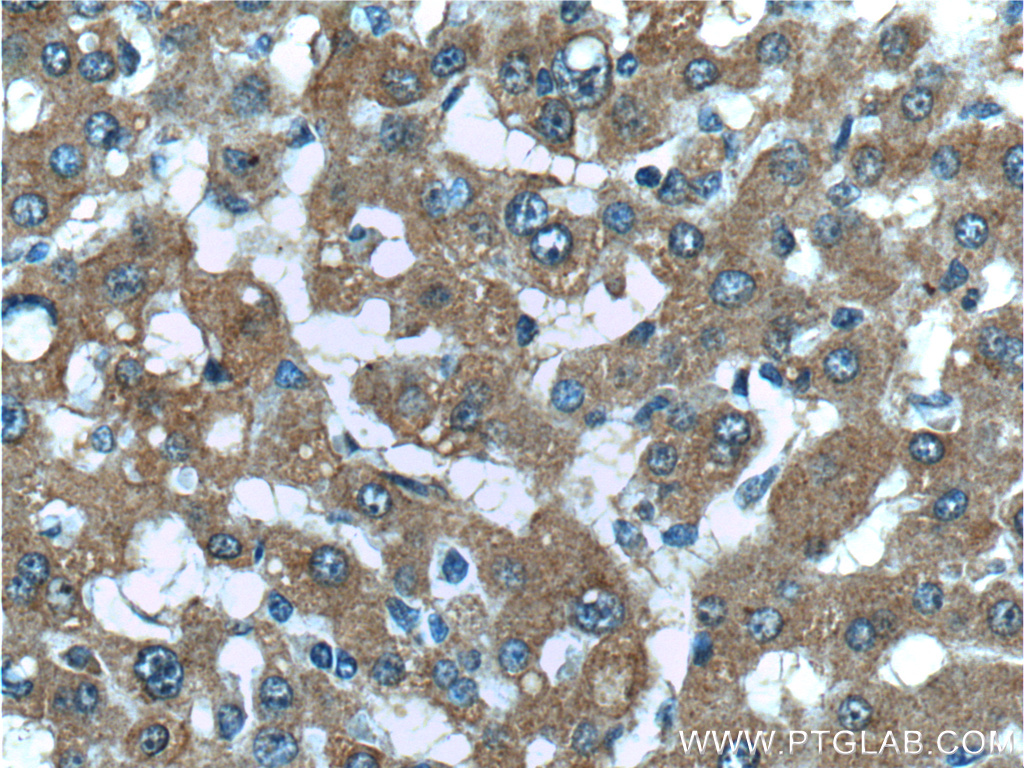 IHC staining of human liver using 26366-1-AP