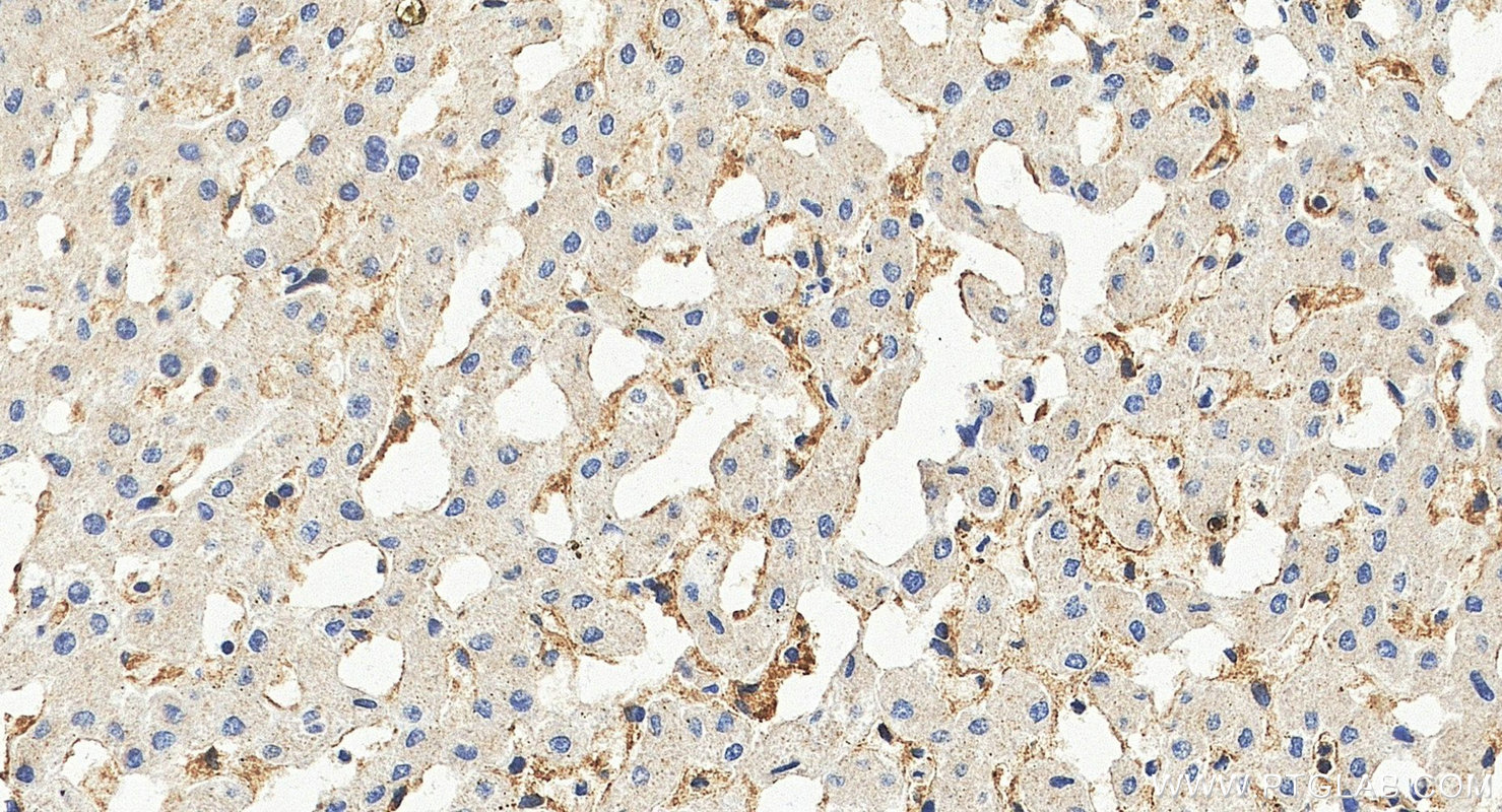 IHC staining of human liver using 26366-1-AP IHC staining of human liver using 26366-1-AP