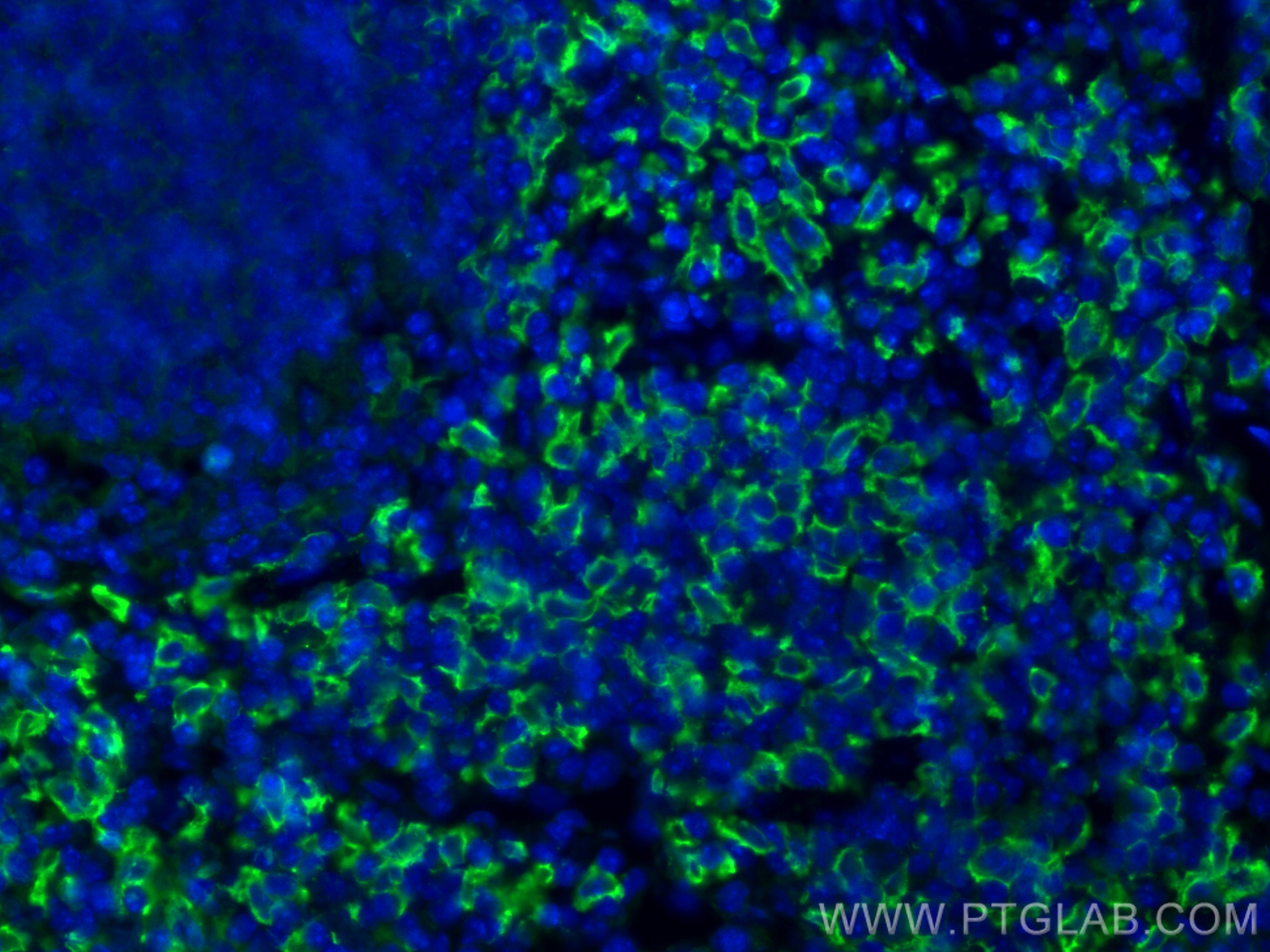 IF Staining of mouse spleen using 28463-1-AP