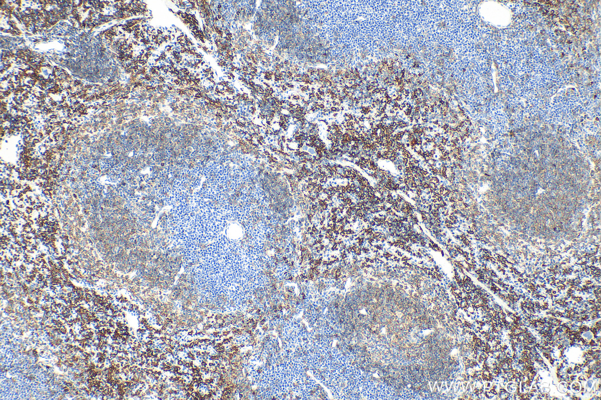 IHC staining of mouse spleen using 28463-1-AP