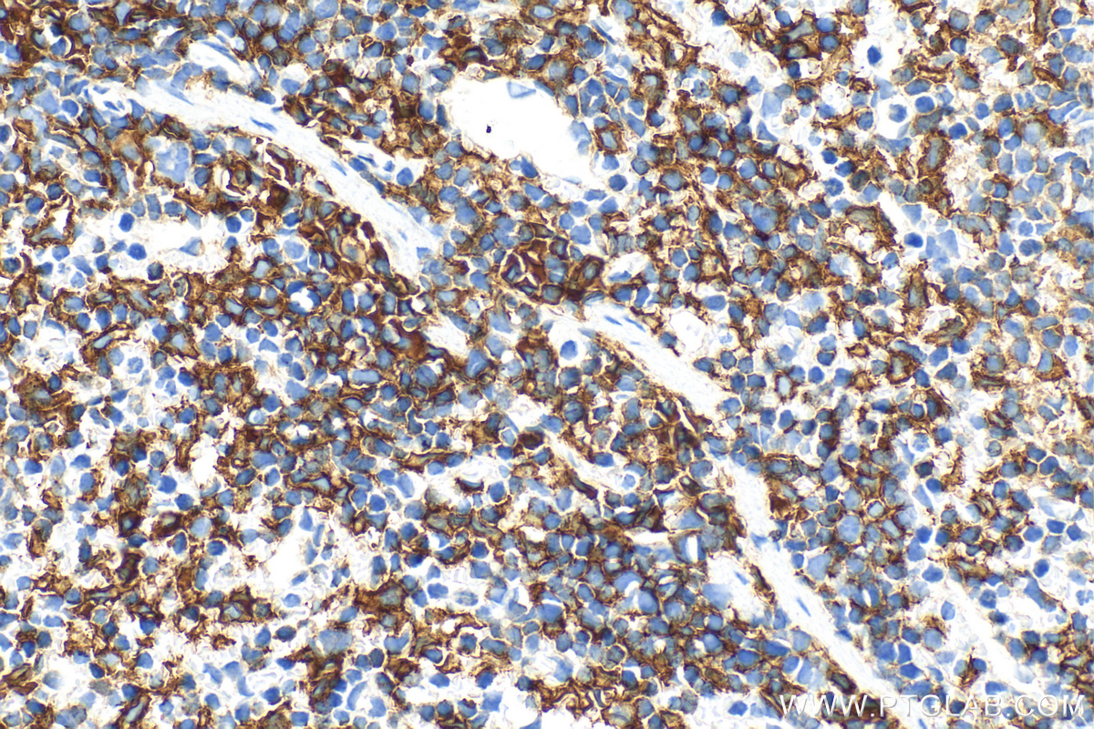 IHC staining of mouse spleen using 28463-1-AP