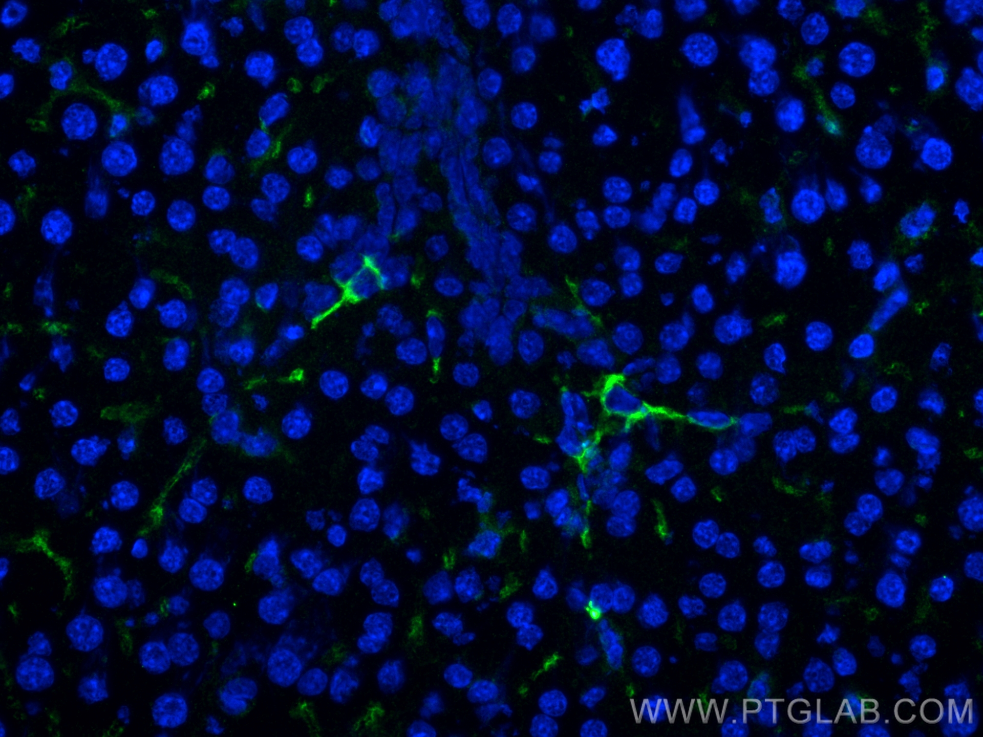 IF Staining of mouse liver using 29414-1-AP