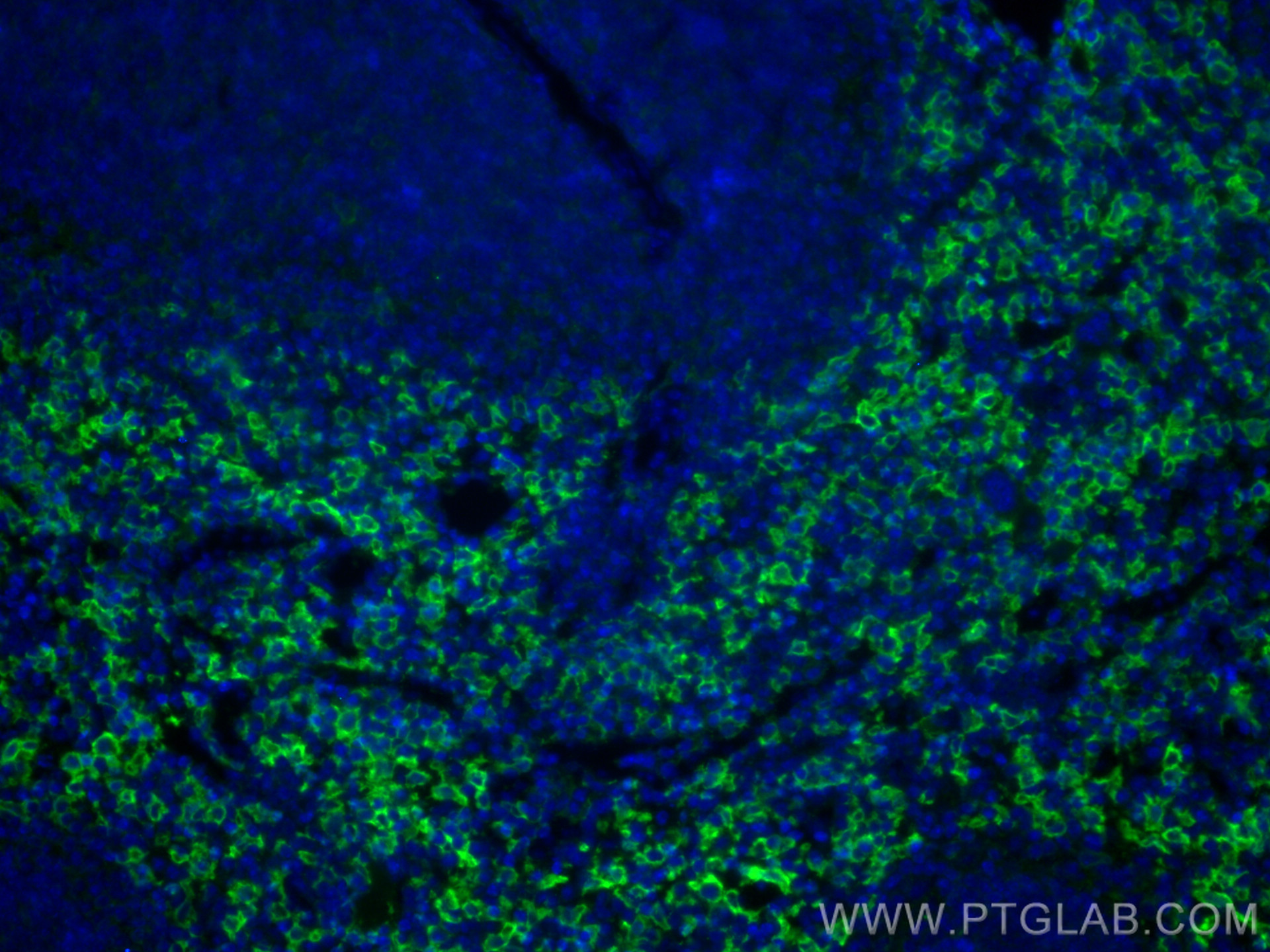 IF Staining of mouse spleen using 81668-1-RR (same clone as 81668-1-PBS)