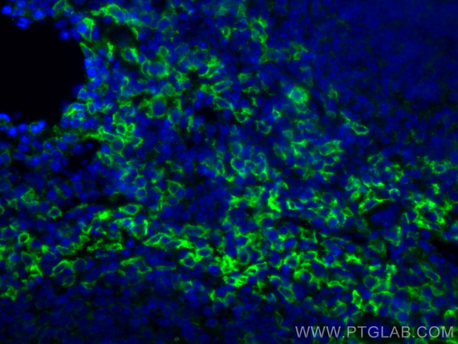 IF Staining of mouse spleen using 81668-1-RR (same clone as 81668-1-PBS)