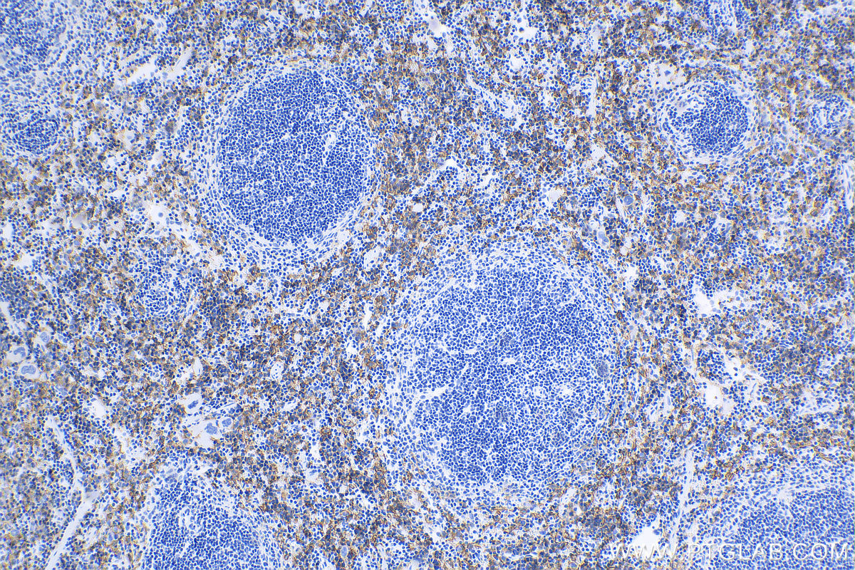 IHC staining of mouse spleen using 81668-1-RR (same clone as 81668-1-PBS)