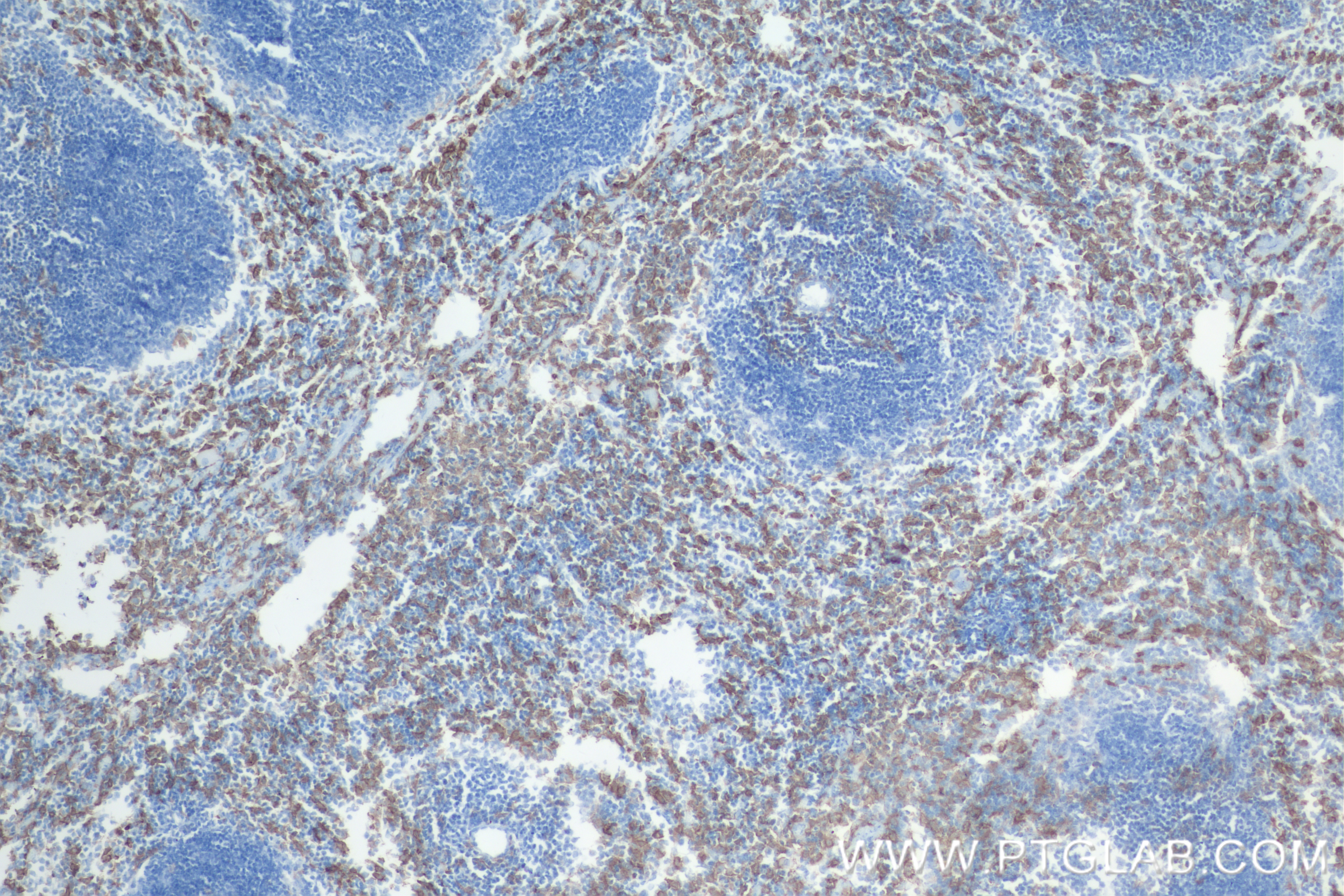 IHC staining of mouse spleen using 84538-1-RR (same clone as 84538-1-PBS)
