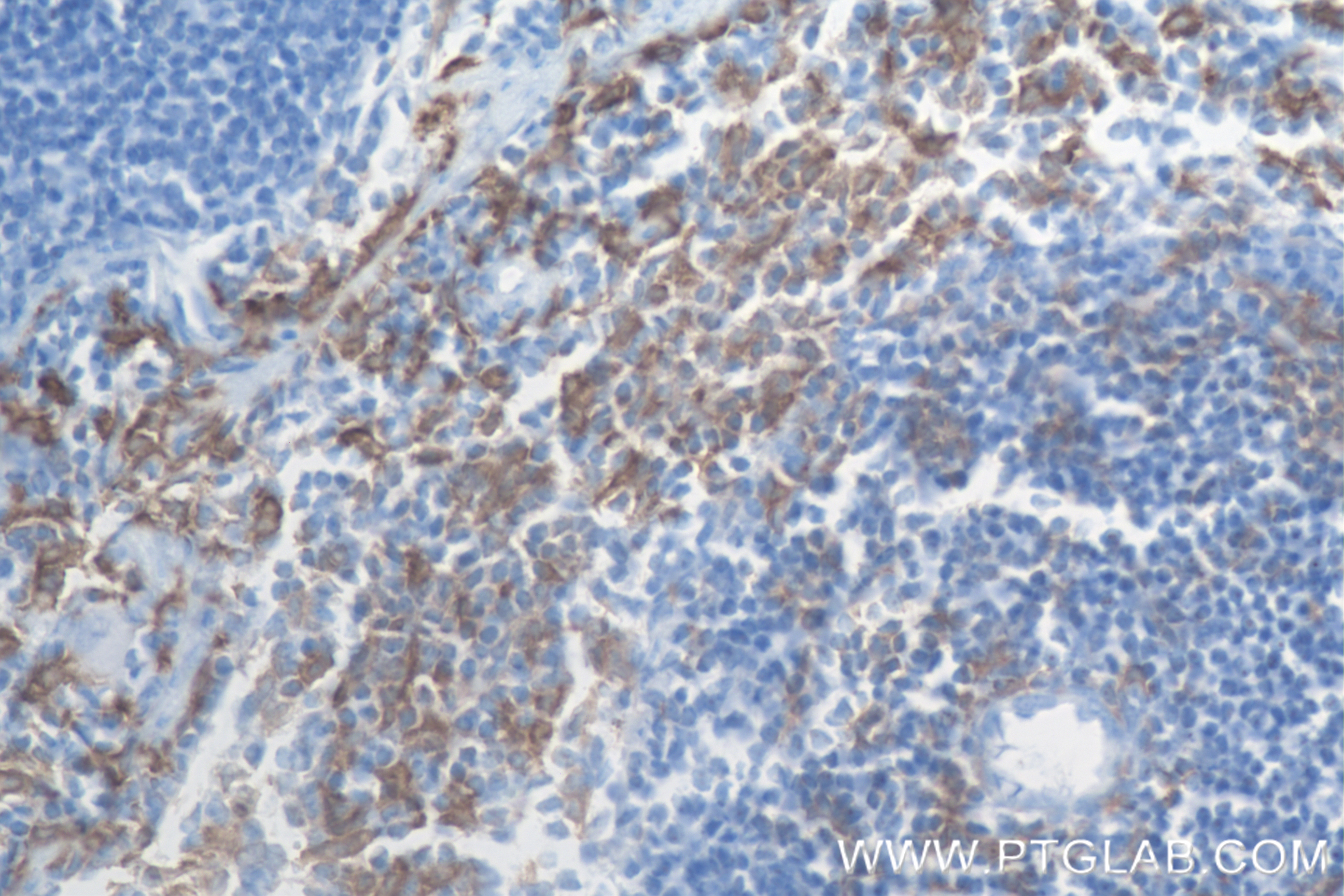 IHC staining of mouse spleen using 84538-1-RR (same clone as 84538-1-PBS)