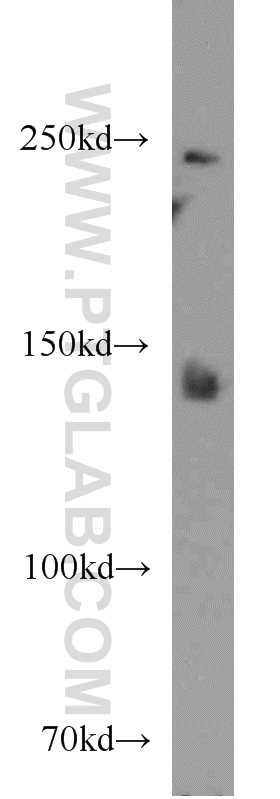 WB analysis of mouse liver using 20963-1-AP