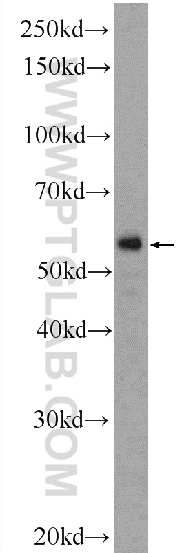 WB analysis of human placenta using 23058-1-AP