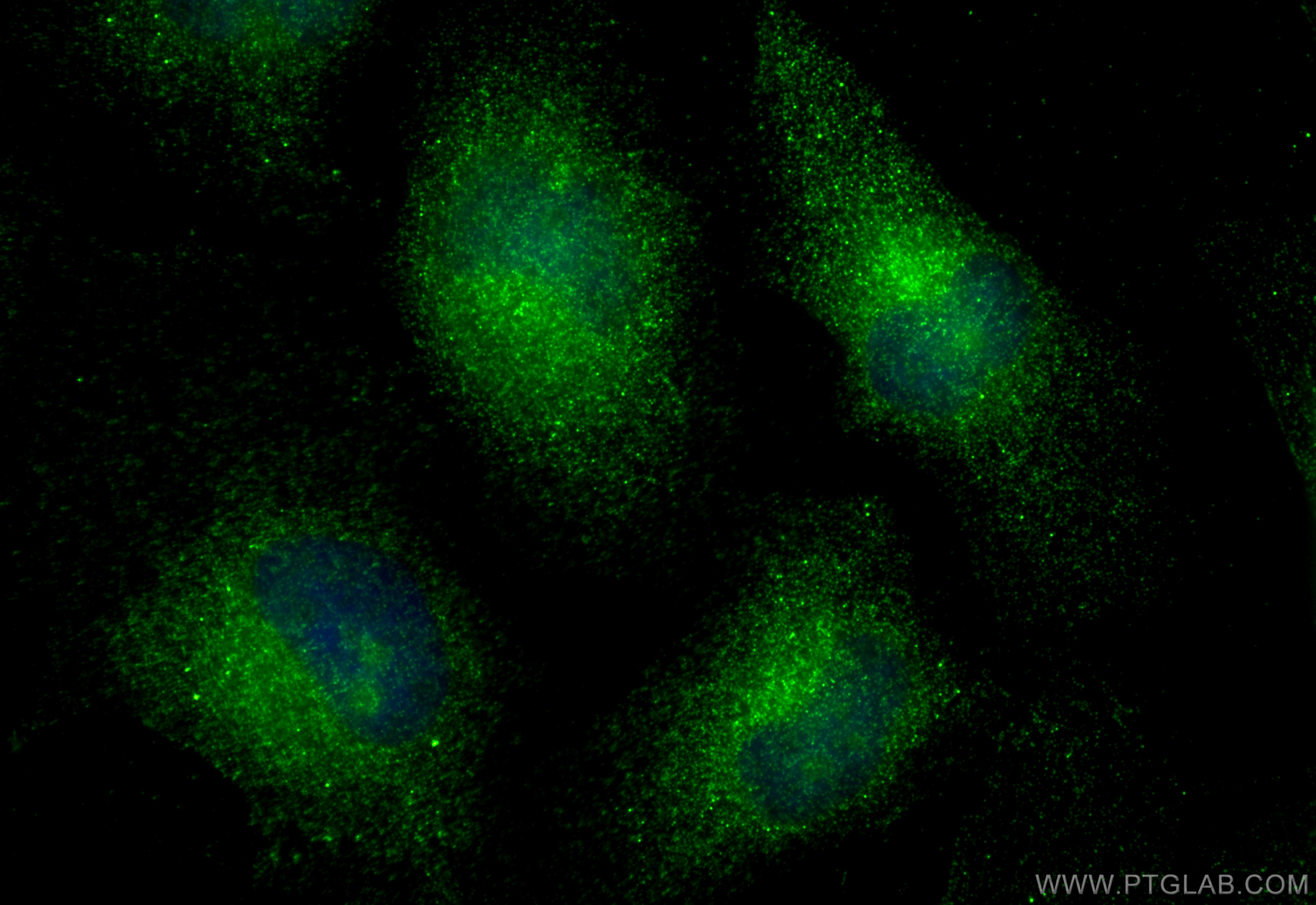 IF Staining of HeLa using 32696-1-AP (same clone as 32696-1-PBS)