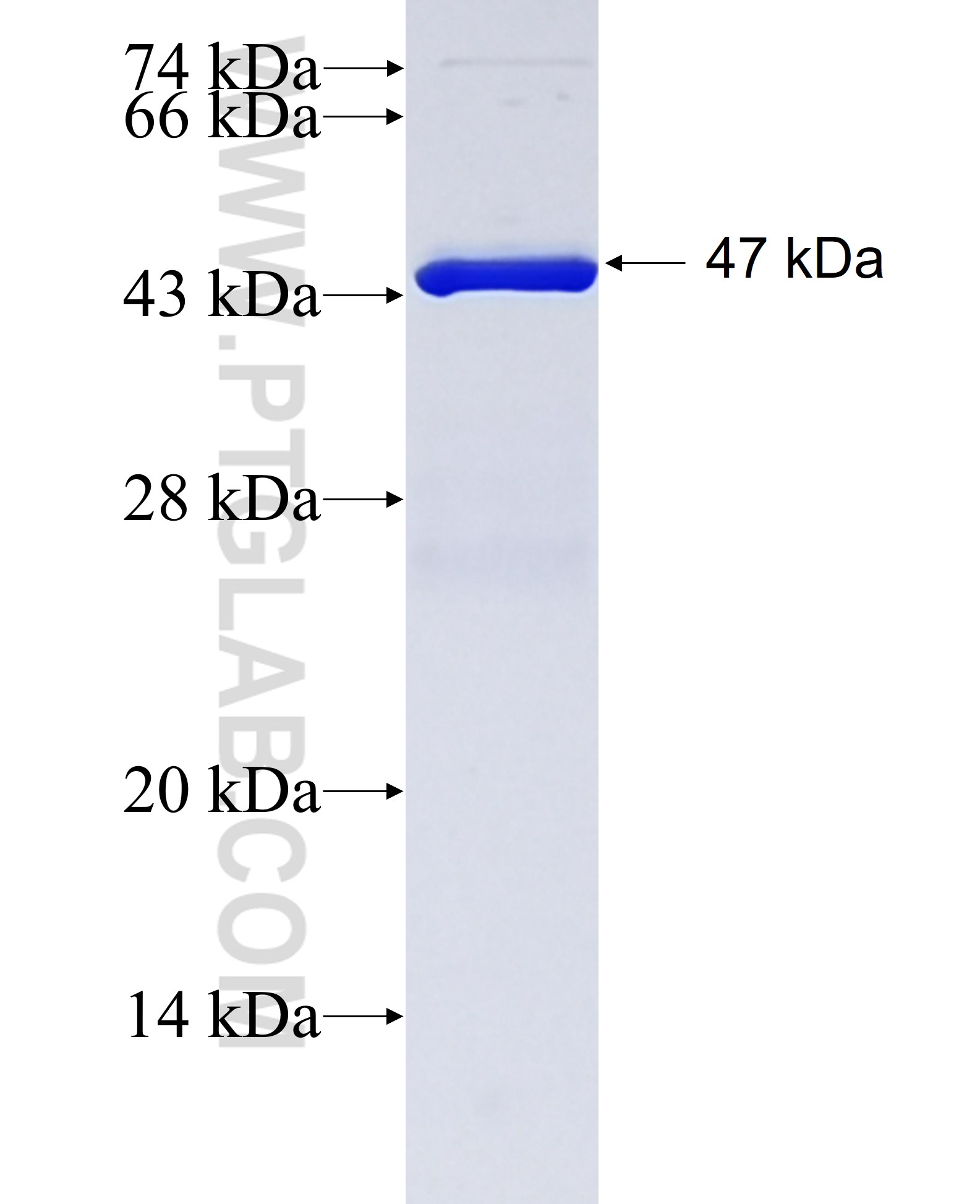 F8A2 fusion protein Ag38529 SDS-PAGE