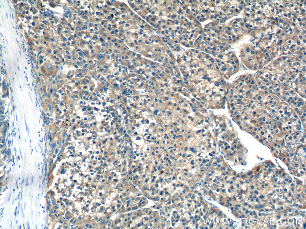 Factor IX/PTC