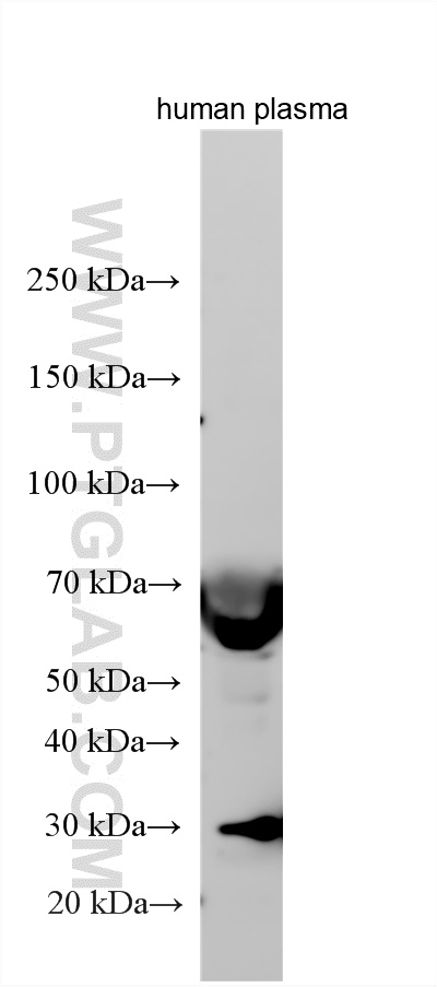 WB analysis using 21481-1-AP (same clone as 21481-1-PBS) WB analysis using 21481-1-AP (same clone as 21481-1-PBS)