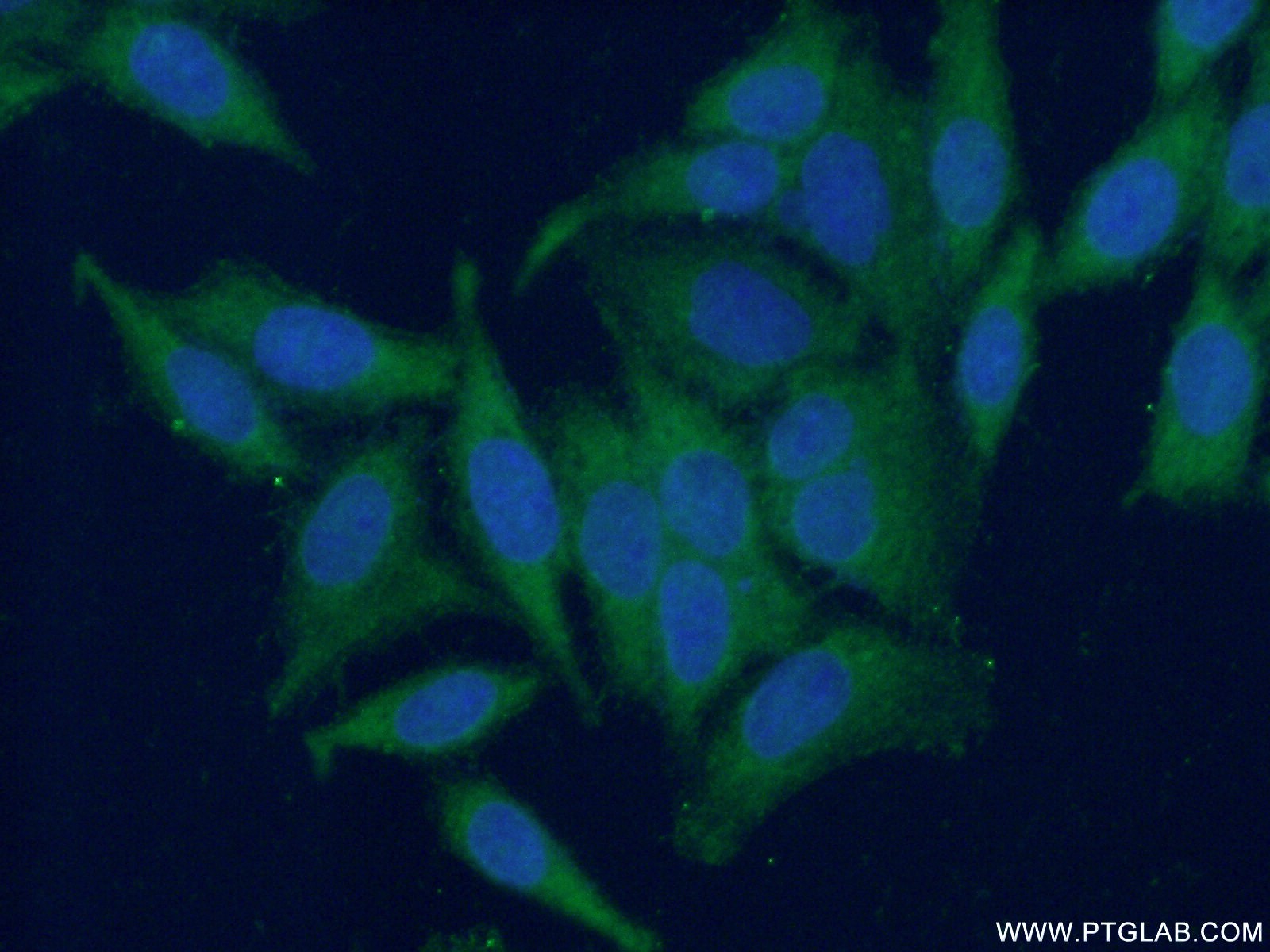 IF Staining of HeLa using 15452-1-AP