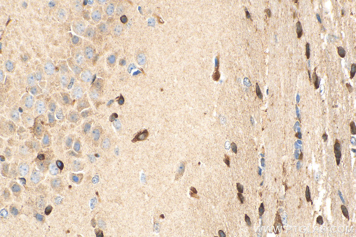 IHC staining of mouse brain using 15452-1-AP