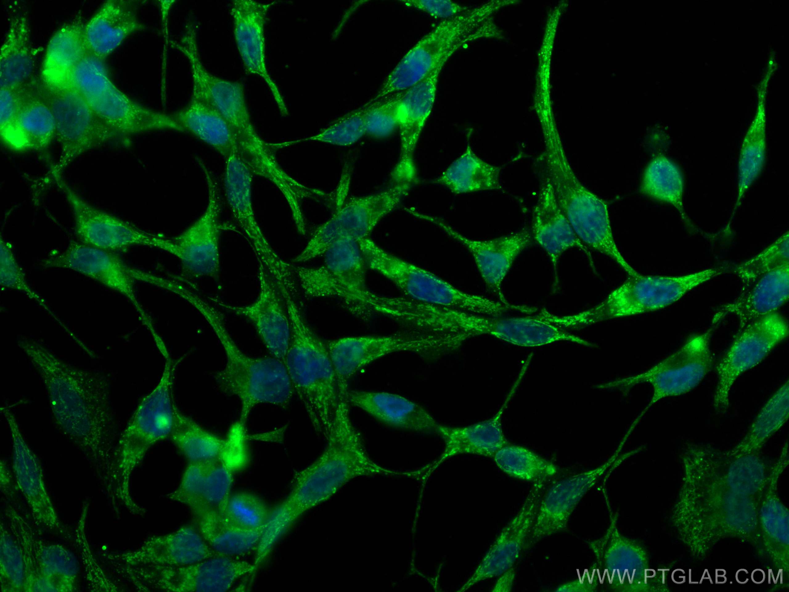 IF Staining of LNCaP using CL488-67607