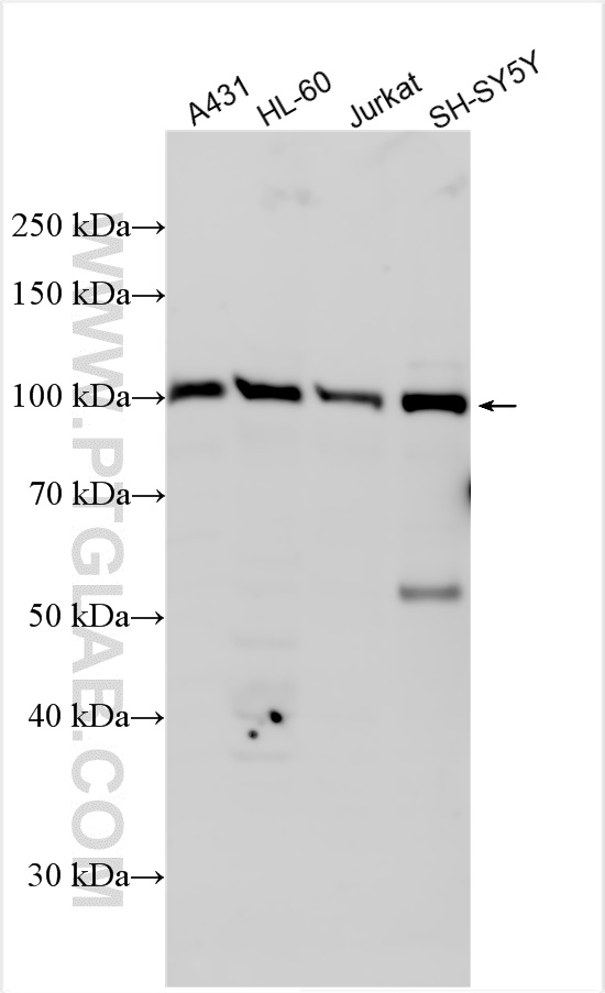 WB analysis using 31841-1-AP