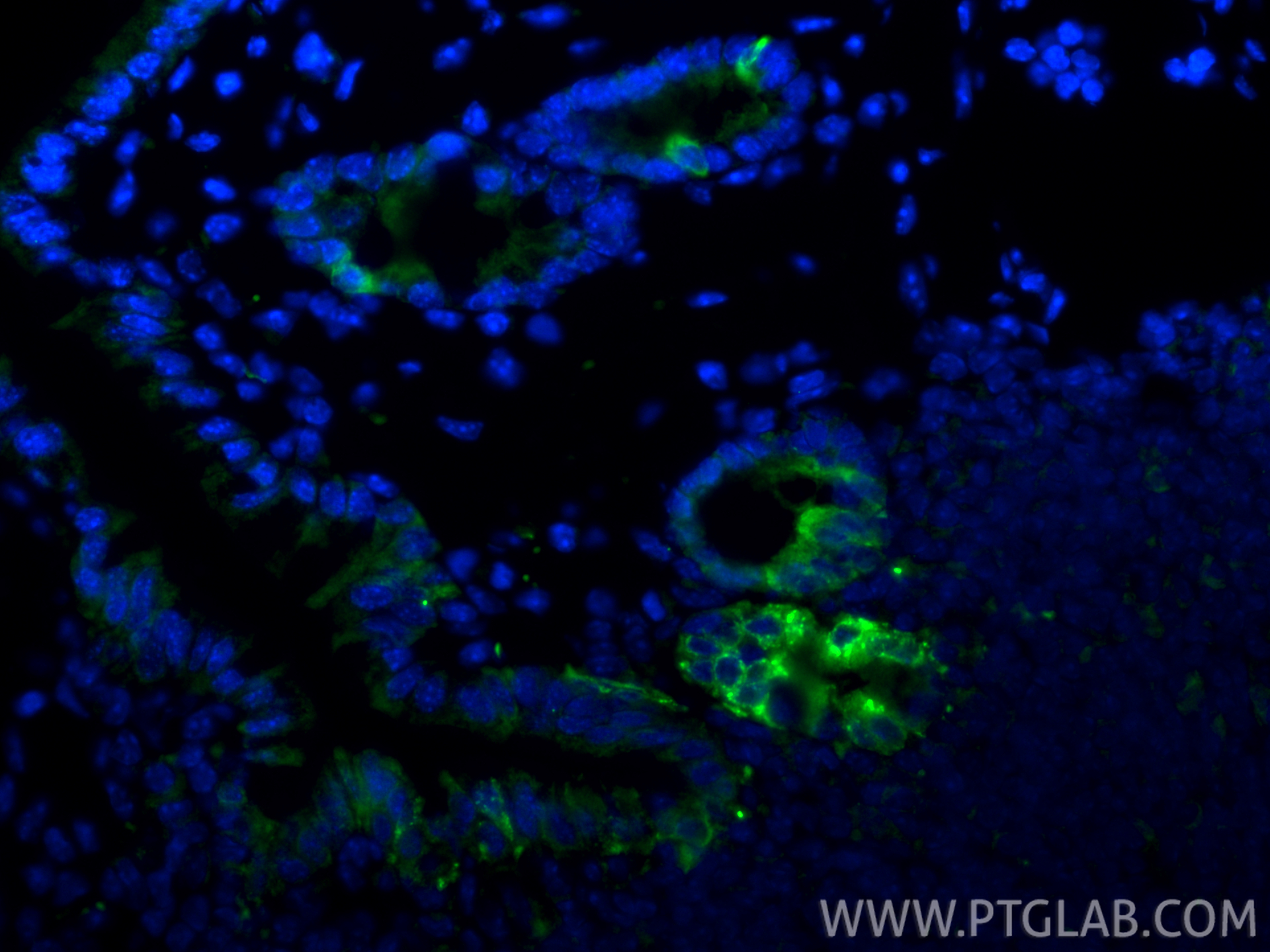 IF Staining of mouse colon using 34024-1-AP