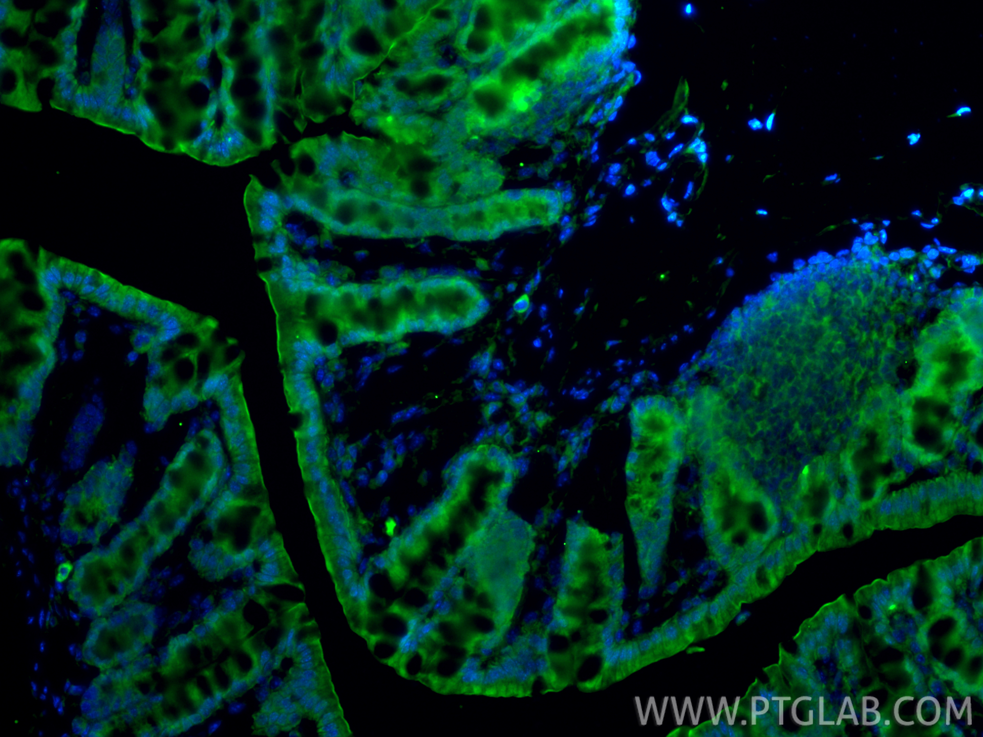 IF Staining of mouse colon using 34024-1-AP