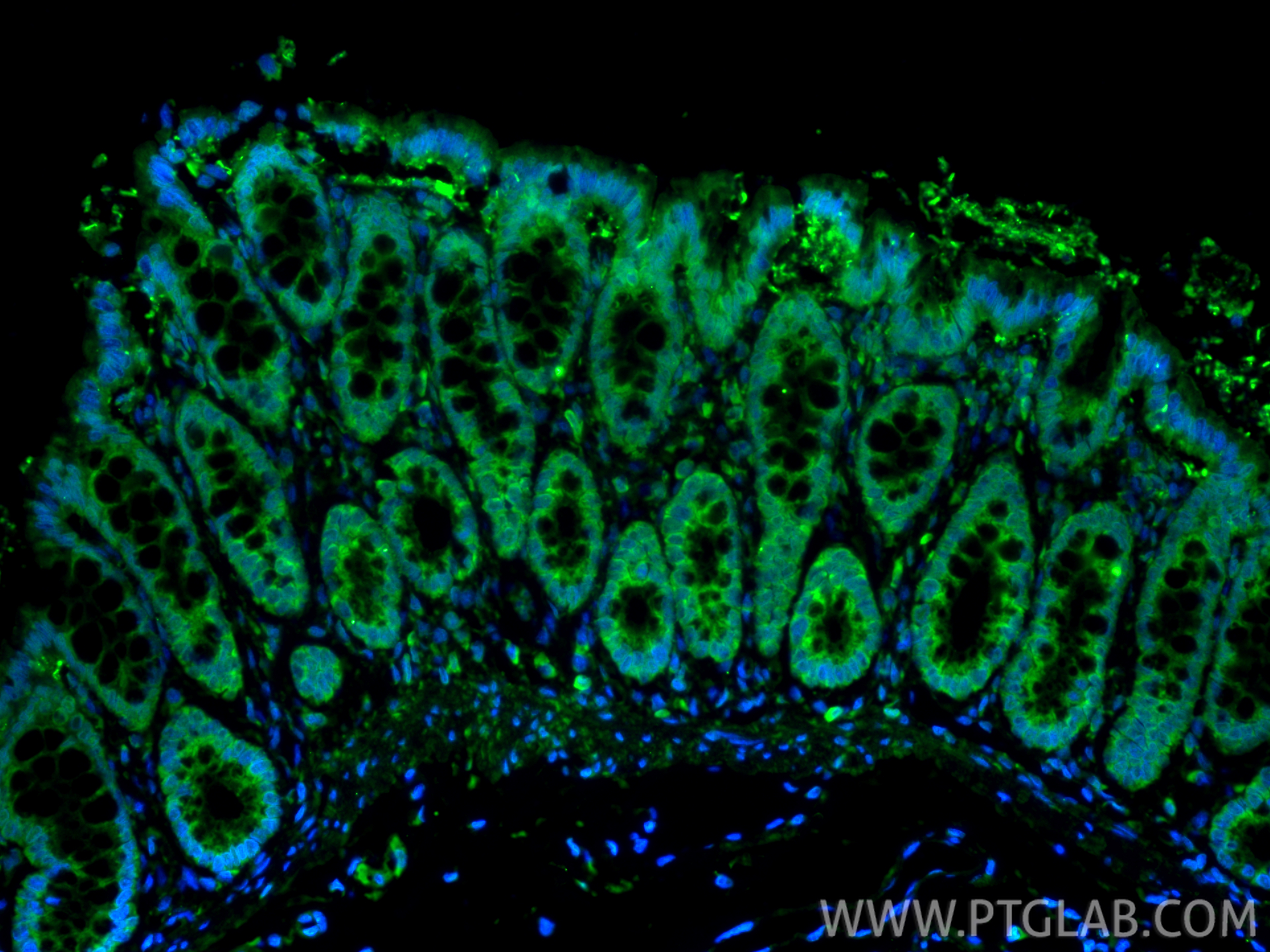 IF Staining of rat colon using 34024-1-AP