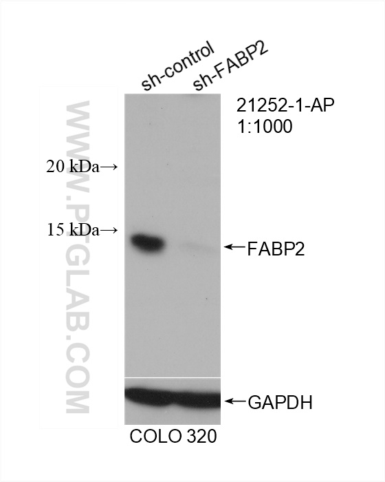 WB analysis of COLO 320 using 21252-1-AP