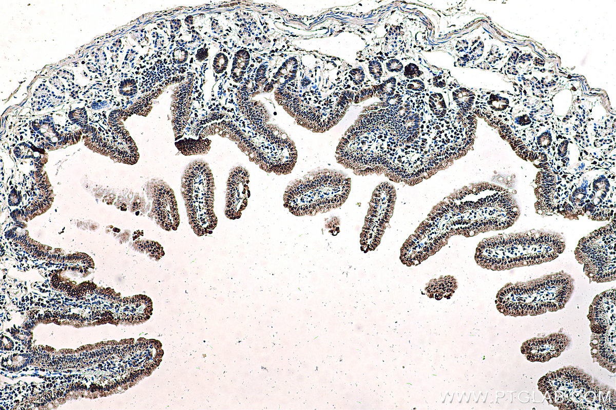 IHC staining of mouse small intestine using 67691-1-Ig (same clone as 67691-1-PBS)