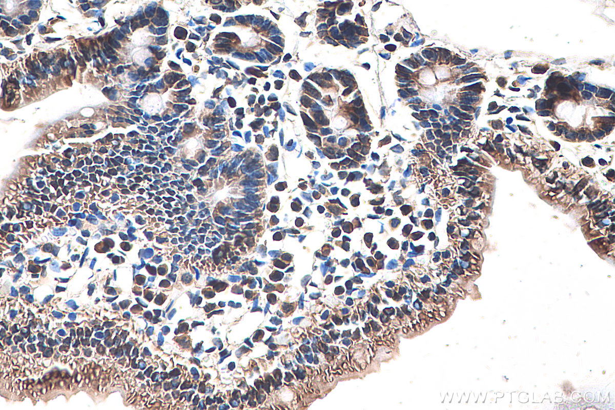 IHC staining of mouse small intestine using 67691-1-Ig (same clone as 67691-1-PBS)