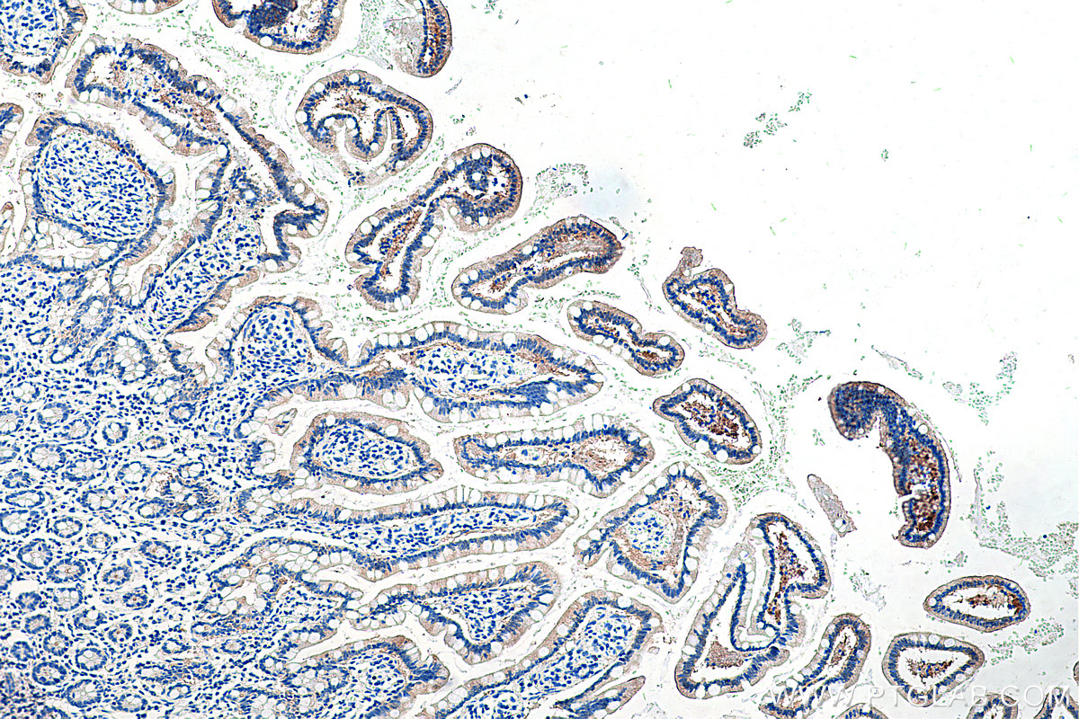 IHC staining of human small intestine using 67691-1-Ig