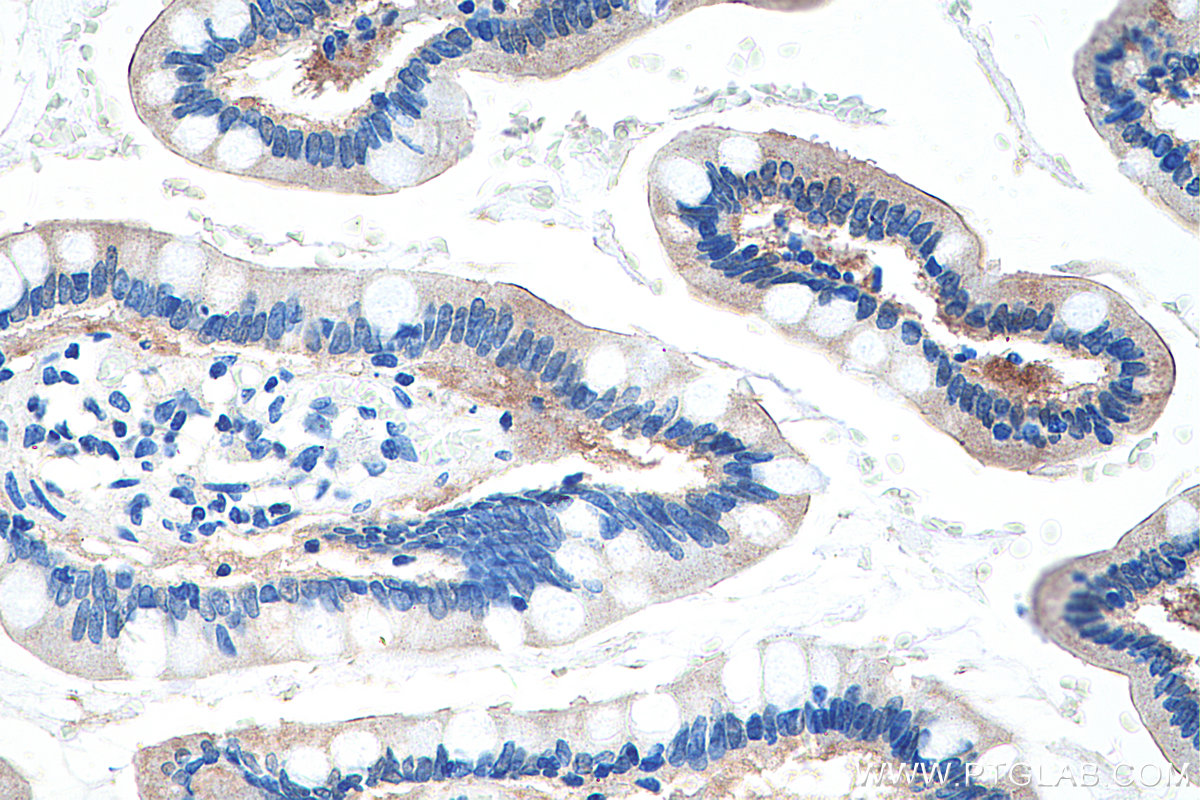 IHC staining of human small intestine using 67691-1-Ig (same clone as 67691-1-PBS)