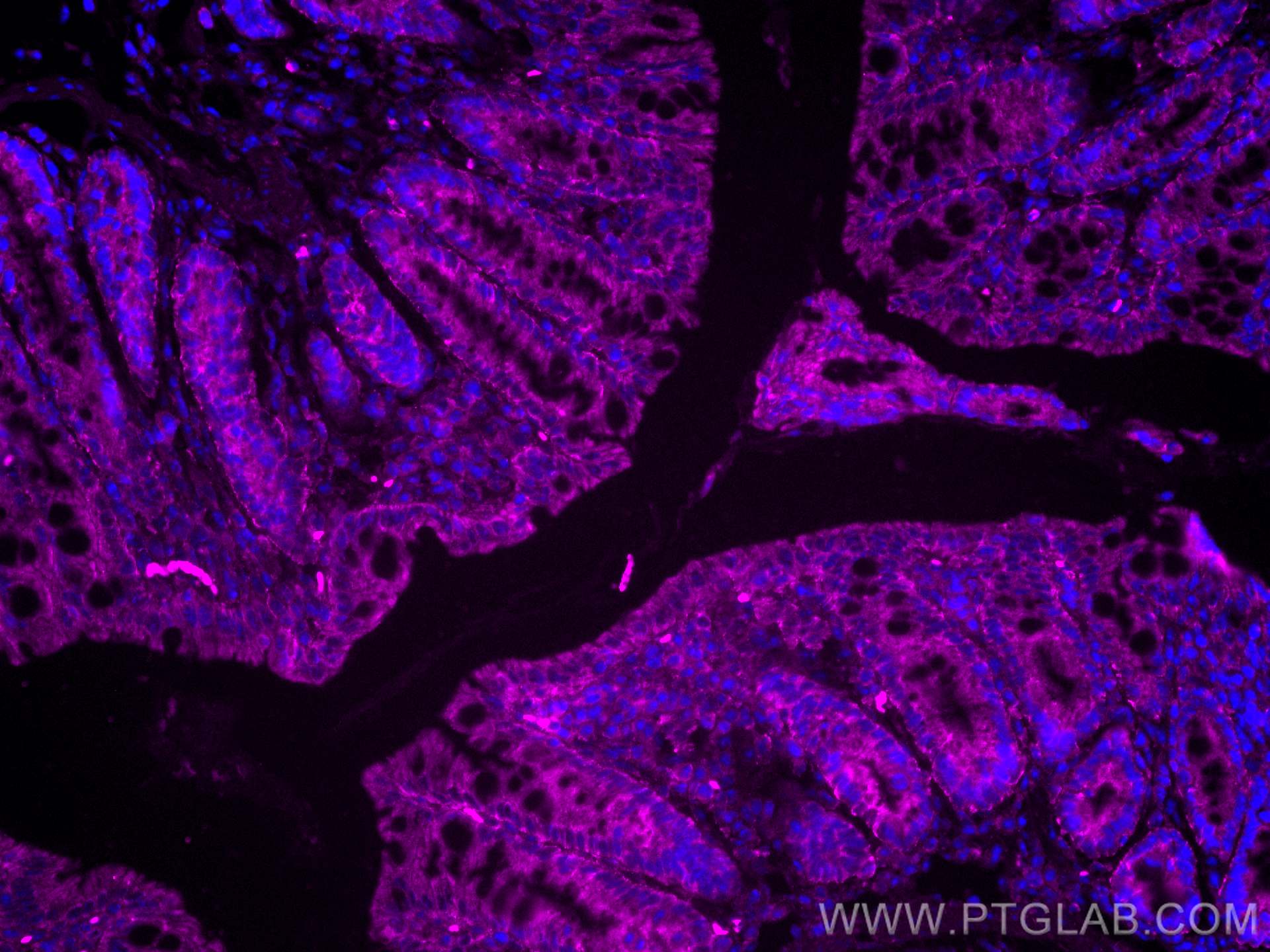 IF Staining of mouse colon using CL647-67691