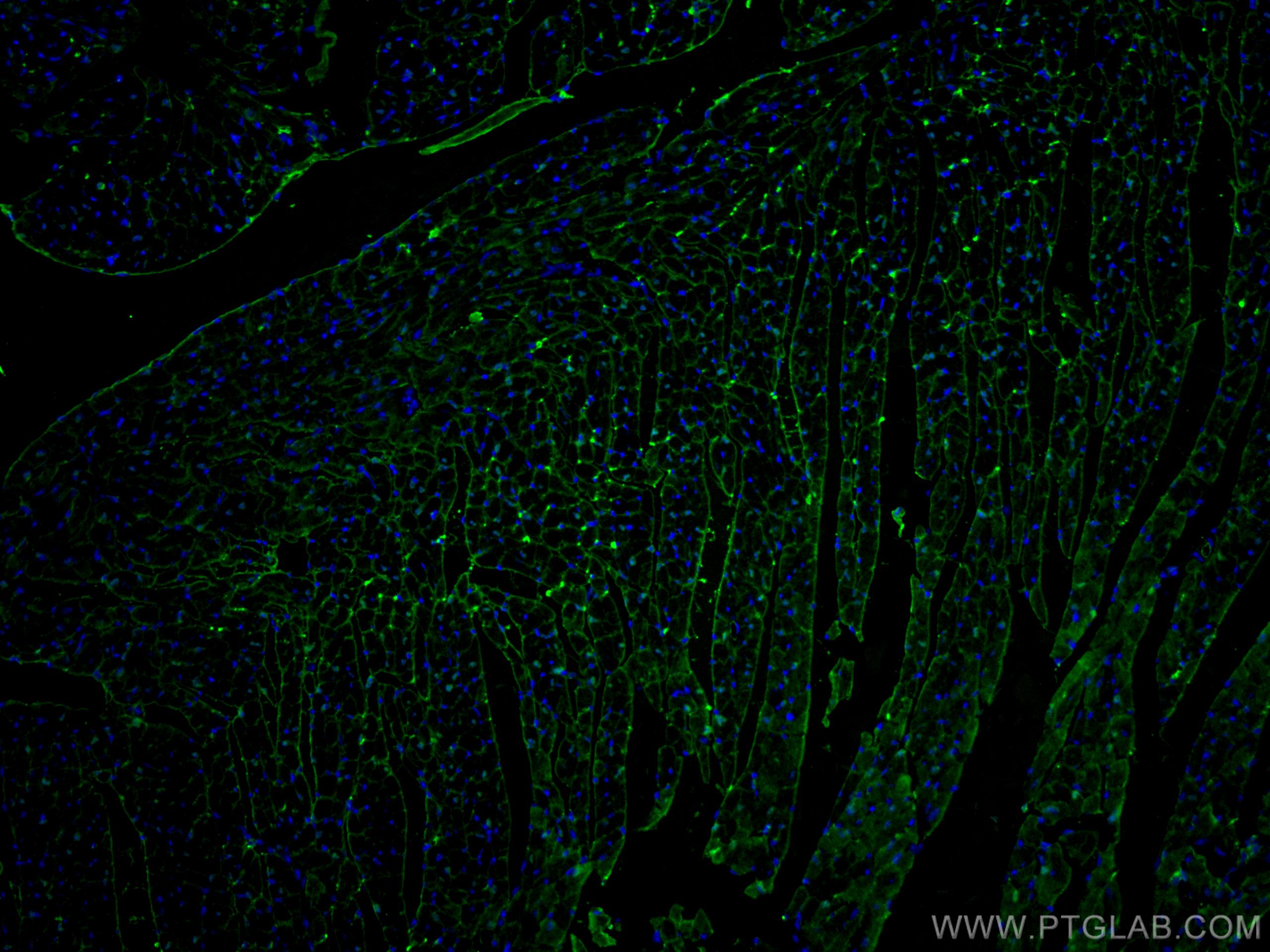 IF Staining of mouse heart using 60280-1-Ig