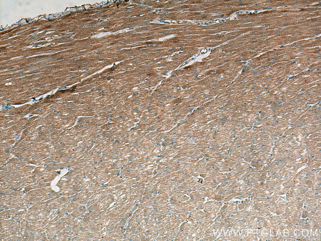 IHC staining of human heart using 60280-1-Ig