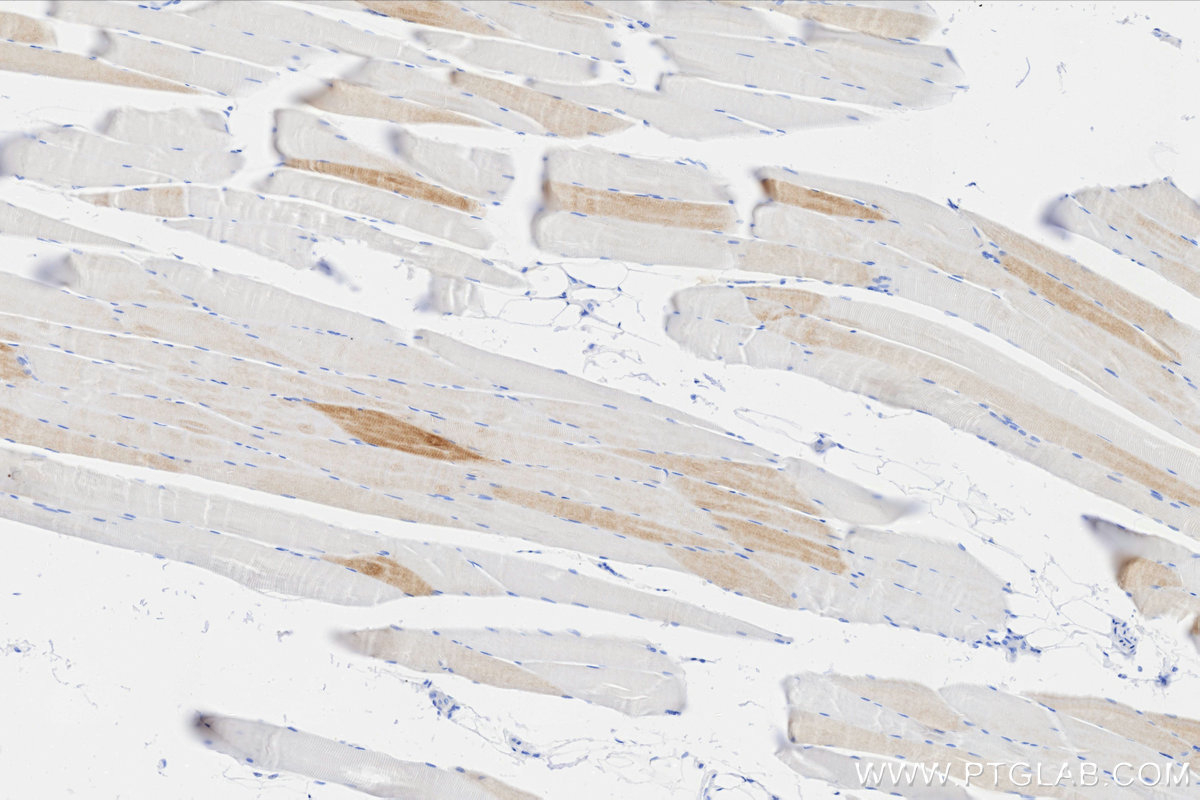IHC staining of human skeletal muscle using 86511-3-RR