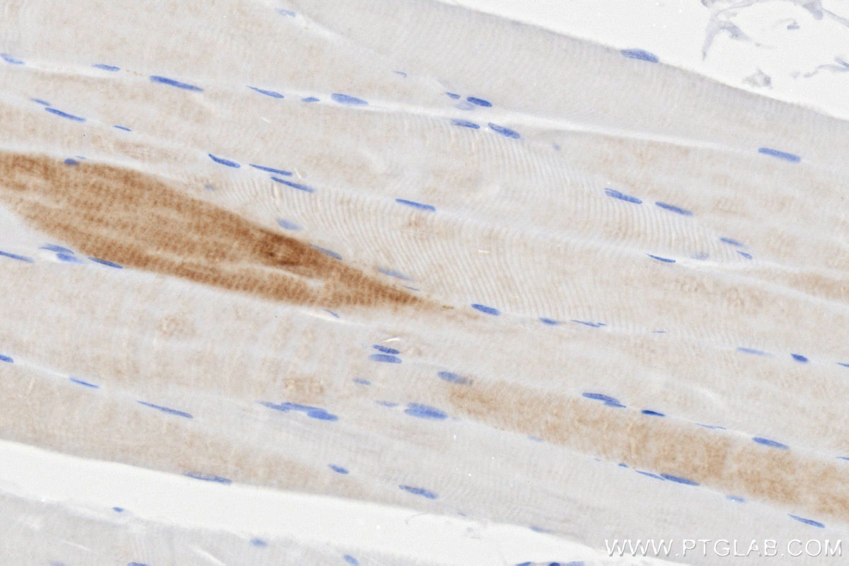 IHC staining of human skeletal muscle using 86511-3-RR