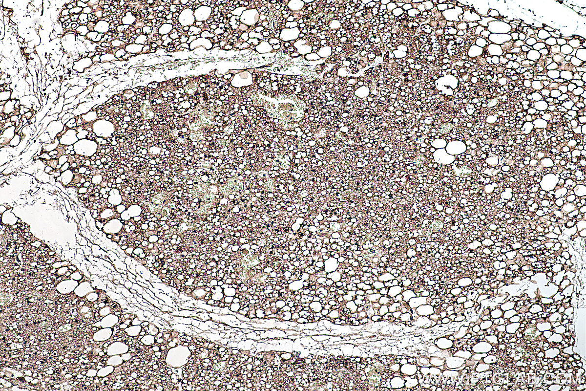 IHC staining of rat brown adipose using 12802-1-AP