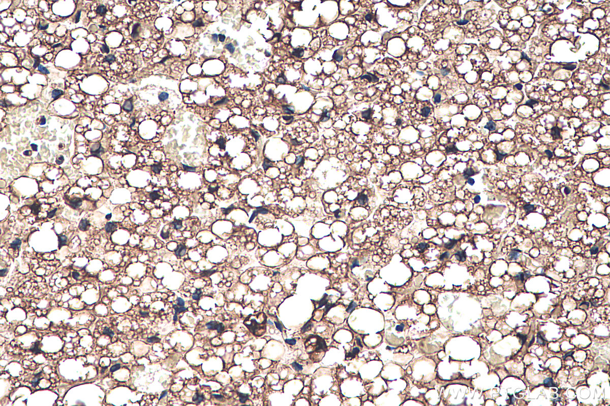 IHC staining of rat brown adipose using 12802-1-AP