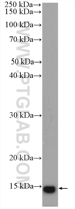 WB analysis of rat skeletal muscle using 15872-1-AP